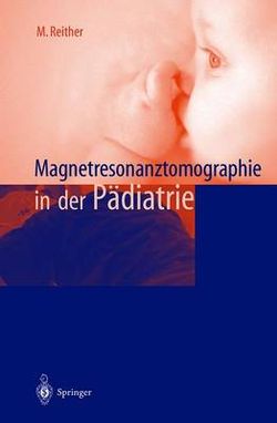 Magnetresonanztomographie in der Paediatrie