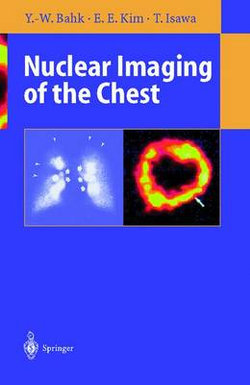 Nuclear Imaging of the Chest