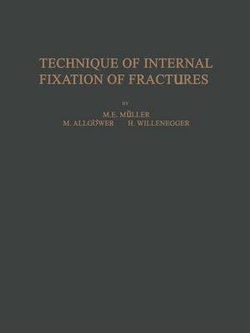 Technique of Internal Fixation of Fractures