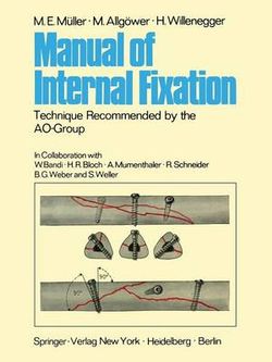 Manual of Internal Fixation