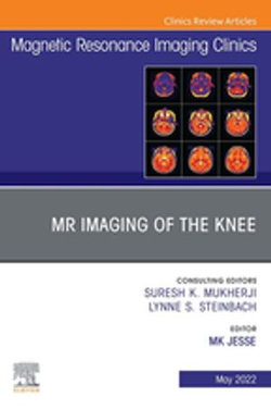 MR Imaging of The Knee, An Issue of Magnetic Resonance Imaging Clinics of North America, E-Book