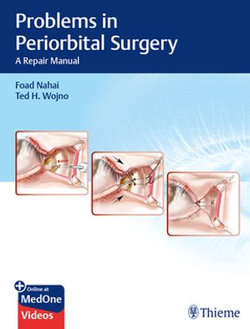 Problems in Periorbital Surgery