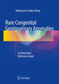 Rare Congenital Genitourinary Anomalies