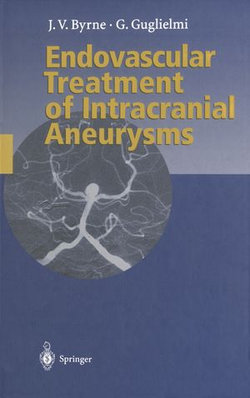 Endovascular Treatment of Intracranial Aneurysms